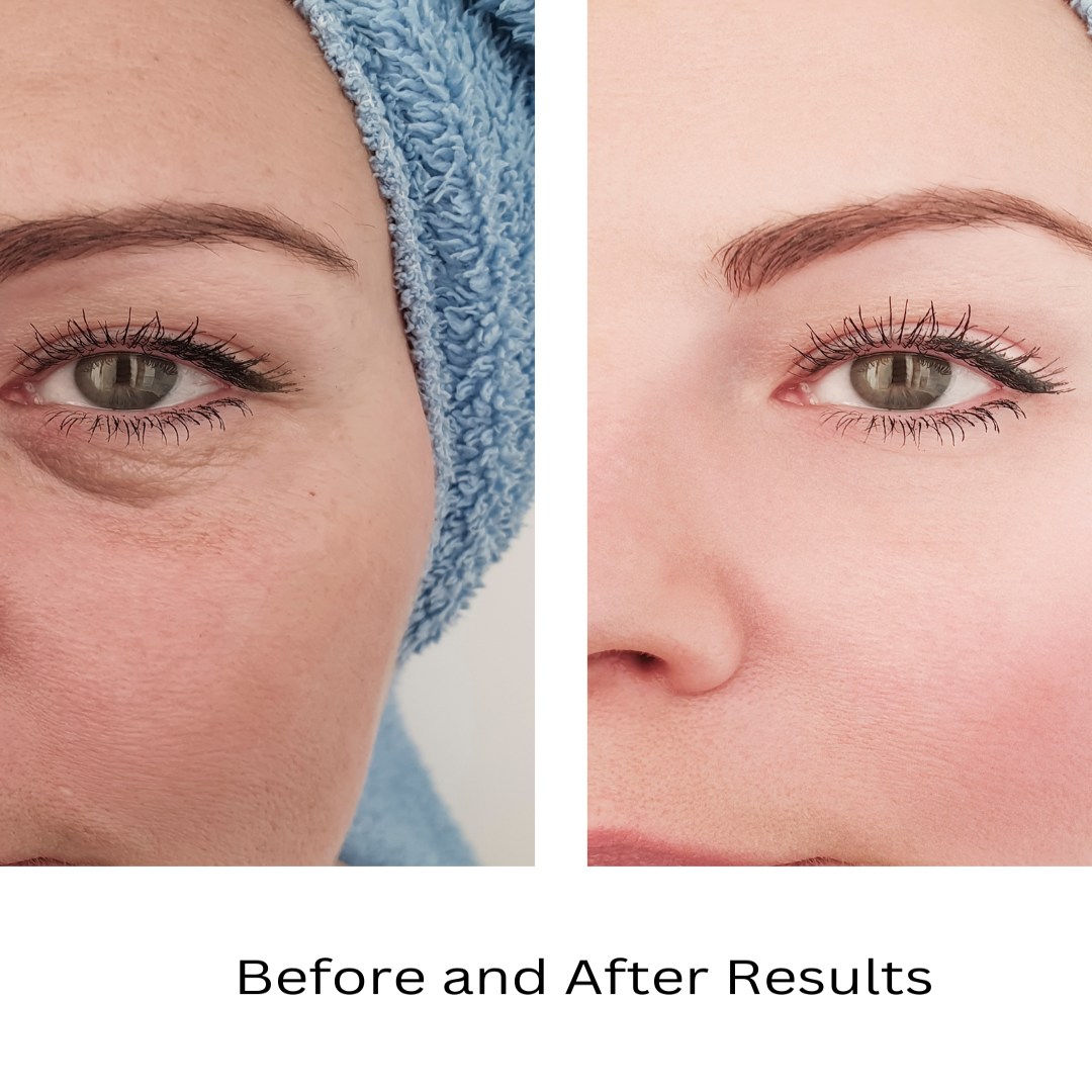 ORGANIC UNDER EYE YOUTH CORRECTOR - For Women